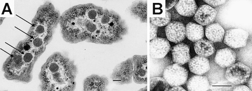 Carboxysomes_EM.jpg